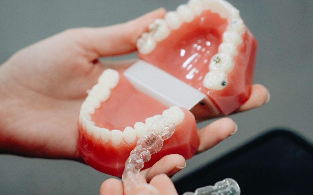 How Often Do You Change Invisalign Trays?
